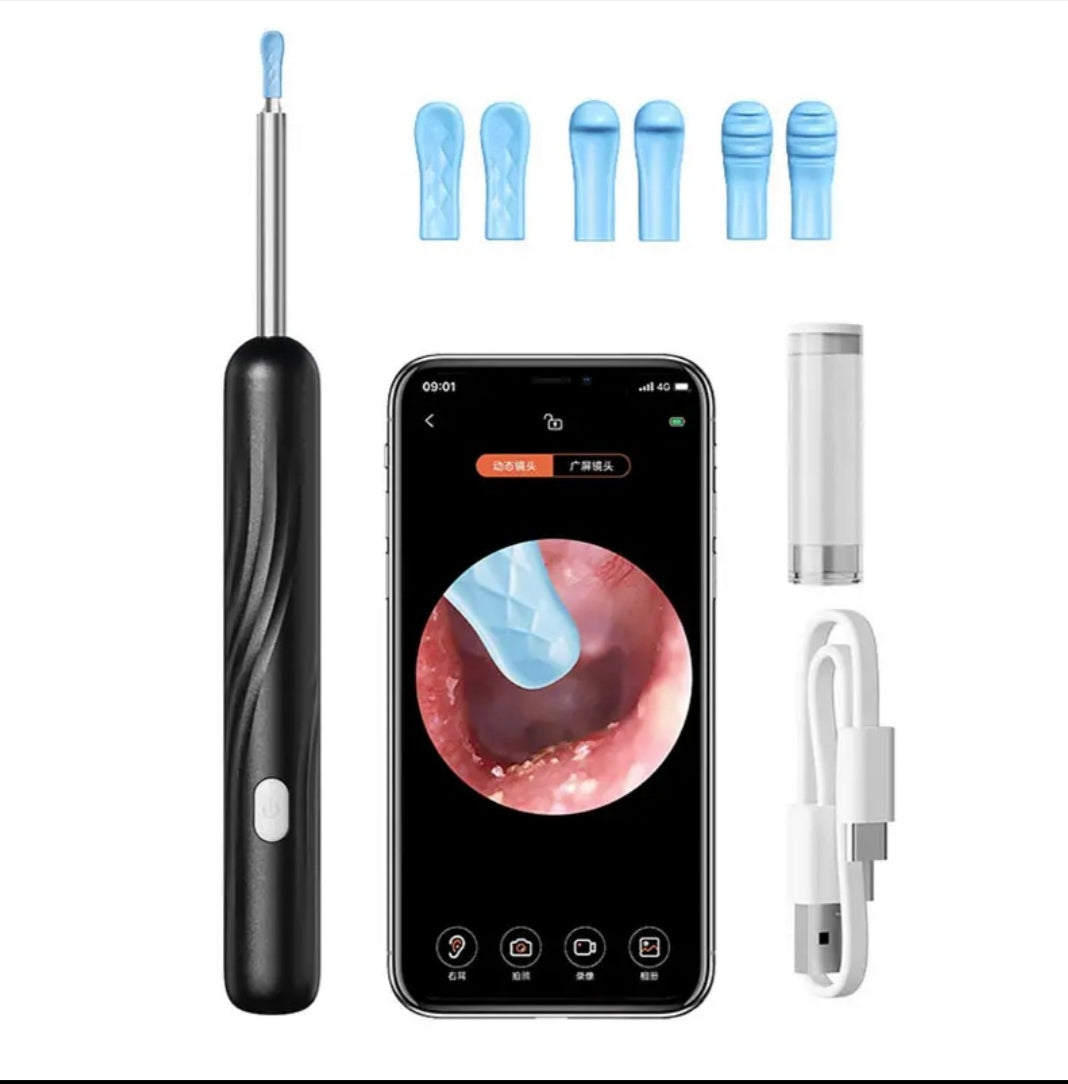 Wireless Smart Visual Ear Cleaner – 1296P HD Camera & LED Lights